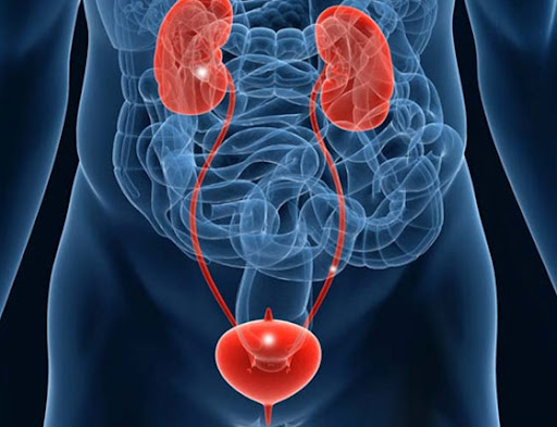 Open Ureterolithotomy